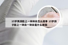 15岁男孩脸上一块块白怎么回事 15岁孩子脸上一块白一块白是什么原因