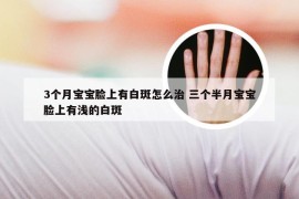 3个月宝宝脸上有白斑怎么治 三个半月宝宝脸上有浅的白斑