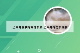 上半身皮肤痒用什么药 上半身痒怎么缓解