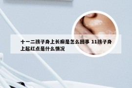 十一二孩子身上长癣是怎么回事 11孩子身上起红点是什么情况