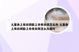 儿童身上有白斑脸上也有白斑怎么办 儿童身上有白斑脸上也有白斑怎么办图片