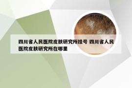 四川省人民医院皮肤研究所挂号 四川省人民医院皮肤研究所在哪里