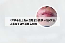 2岁孩子脸上有白点是怎么回事 小孩2岁脸上出现小白块是什么原因