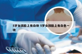 5岁女孩脸上有白块 5岁女孩脸上有白色一块