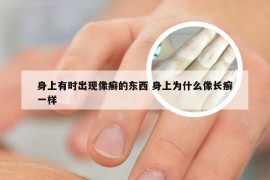 身上有时出现像癣的东西 身上为什么像长癣一样