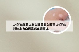 14岁女孩脸上有白斑是怎么回事 14岁女孩脸上有白斑是怎么回事儿