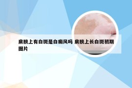 肩膀上有白斑是白癜风吗 肩膀上长白斑初期图片