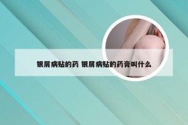 银屑病贴的药 银屑病贴的药膏叫什么