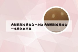 大腿根部皮肤变白一小块 大腿根部皮肤变白一小块怎么回事