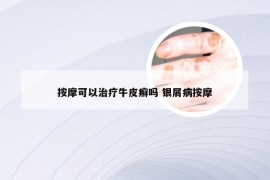 按摩可以治疗牛皮癣吗 银屑病按摩