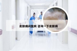 皮肤病问医网 咨询一下皮肤病