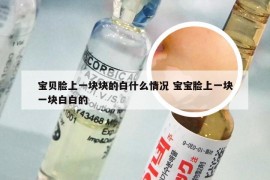 宝贝脸上一块块的白什么情况 宝宝脸上一块一块白白的