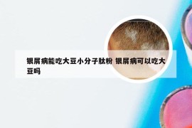 银屑病能吃大豆小分子肽粉 银屑病可以吃大豆吗