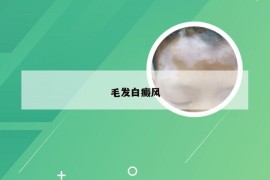 毛发白癜风