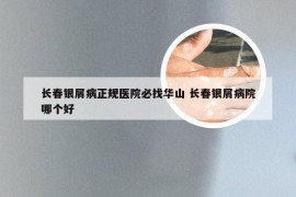 长春银屑病正规医院必找华山 长春银屑病院哪个好